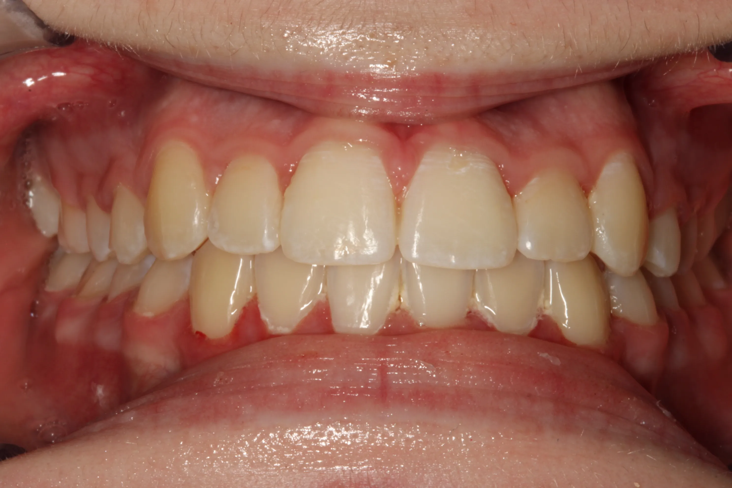 smile-gallery gallery